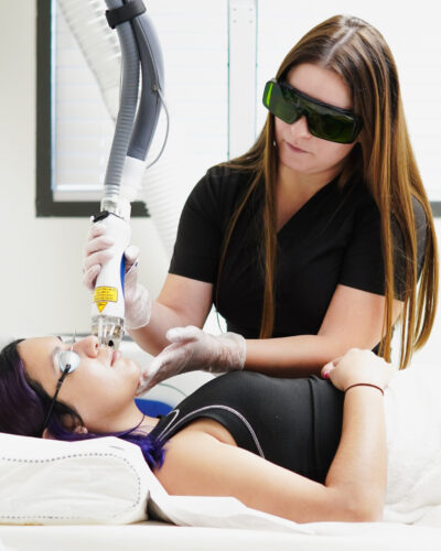 Female client getting laser hair removal on upper lip